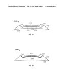 FISTULA TREATMENT DEVICES AND RELATED METHODS diagram and image