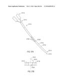 FISTULA TREATMENT DEVICES AND RELATED METHODS diagram and image