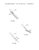 FISTULA TREATMENT DEVICES AND RELATED METHODS diagram and image