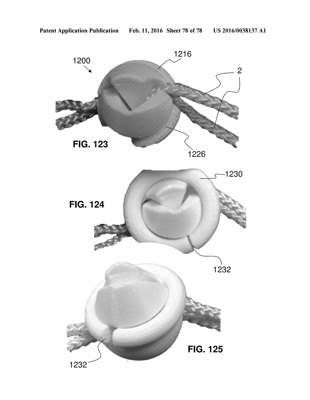 Multiple-Firing Suture Fixation Device and Methods for Using and     Manufacturing Same - diagram, schematic, and image 79
