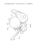 FEMORAL ACETABULAR IMPINGEMENT GUIDE diagram and image