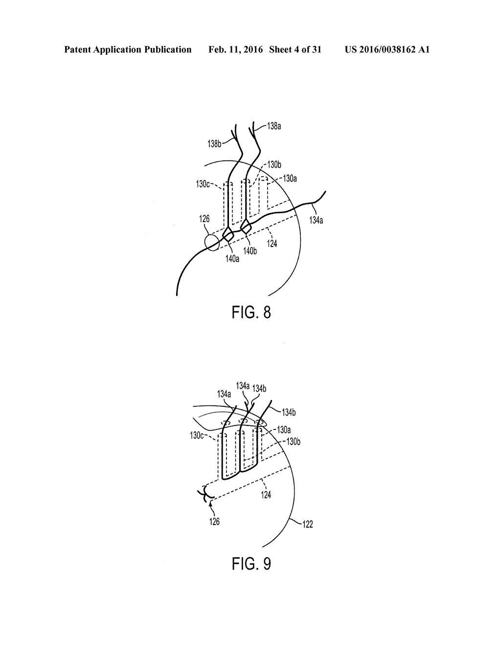 Methods and Devices for Forming Bone Tunnels - diagram, schematic, and image 05