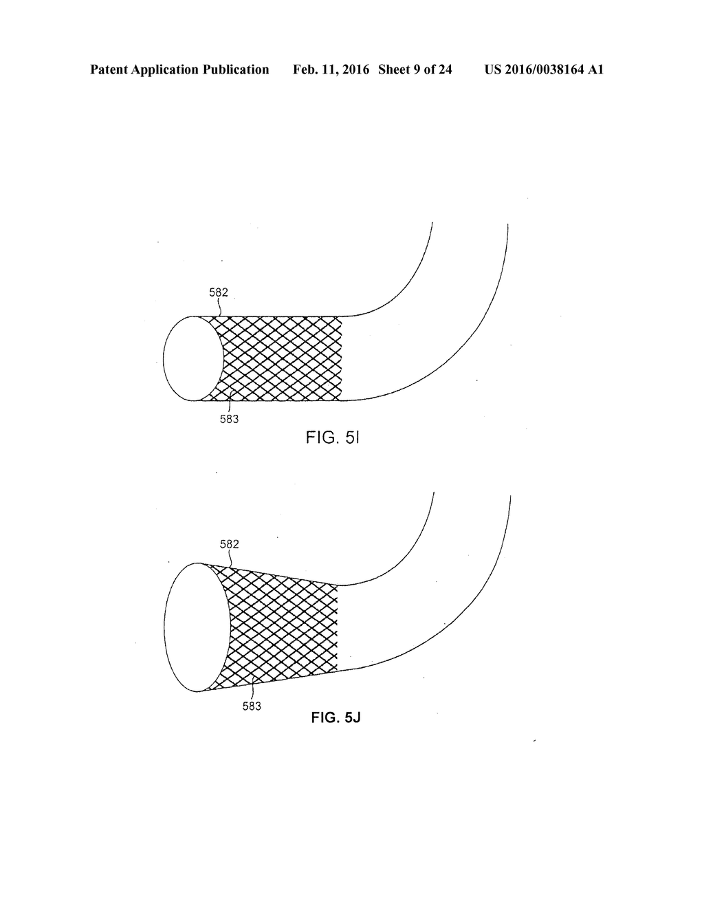 RECANALIZING OCCLUDED VESSELS USING CONTROLLED ANTEGRADE AND RETROGRADE     TRACKING - diagram, schematic, and image 10