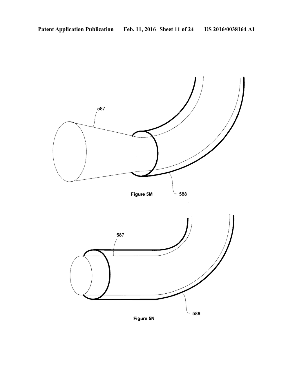 RECANALIZING OCCLUDED VESSELS USING CONTROLLED ANTEGRADE AND RETROGRADE     TRACKING - diagram, schematic, and image 12