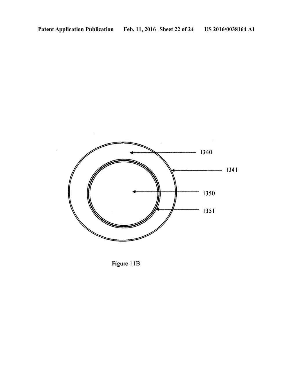 RECANALIZING OCCLUDED VESSELS USING CONTROLLED ANTEGRADE AND RETROGRADE     TRACKING - diagram, schematic, and image 23