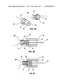 DEVICES AND METHODS FOR BONE ANCHORING diagram and image