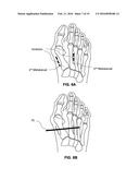 DEVICES AND METHODS FOR BONE ANCHORING diagram and image