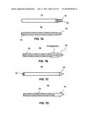 DEVICES AND METHODS FOR BONE ANCHORING diagram and image