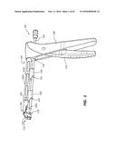 ROD REDUCTION TOOL AND METHOD TO ASSIST IN THE PASSAGE OF A CONNECTING ROD     BETWEEN PEDICLE SCREWS diagram and image