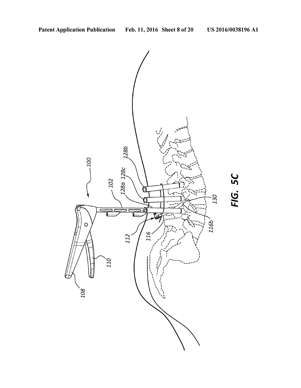 ROD REDUCTION TOOL AND METHOD TO ASSIST IN THE PASSAGE OF A CONNECTING ROD     BETWEEN PEDICLE SCREWS - diagram, schematic, and image 09