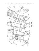 ROD REDUCTION TOOL AND METHOD TO ASSIST IN THE PASSAGE OF A CONNECTING ROD     BETWEEN PEDICLE SCREWS diagram and image