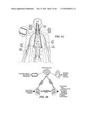 Cryoablation Apparatuses, Systems, and Methods for Renal Neuromodulation diagram and image