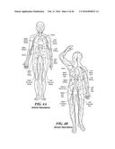 Cryoablation Apparatuses, Systems, and Methods for Renal Neuromodulation diagram and image