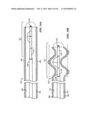 Cryoablation Apparatuses, Systems, and Methods for Renal Neuromodulation diagram and image