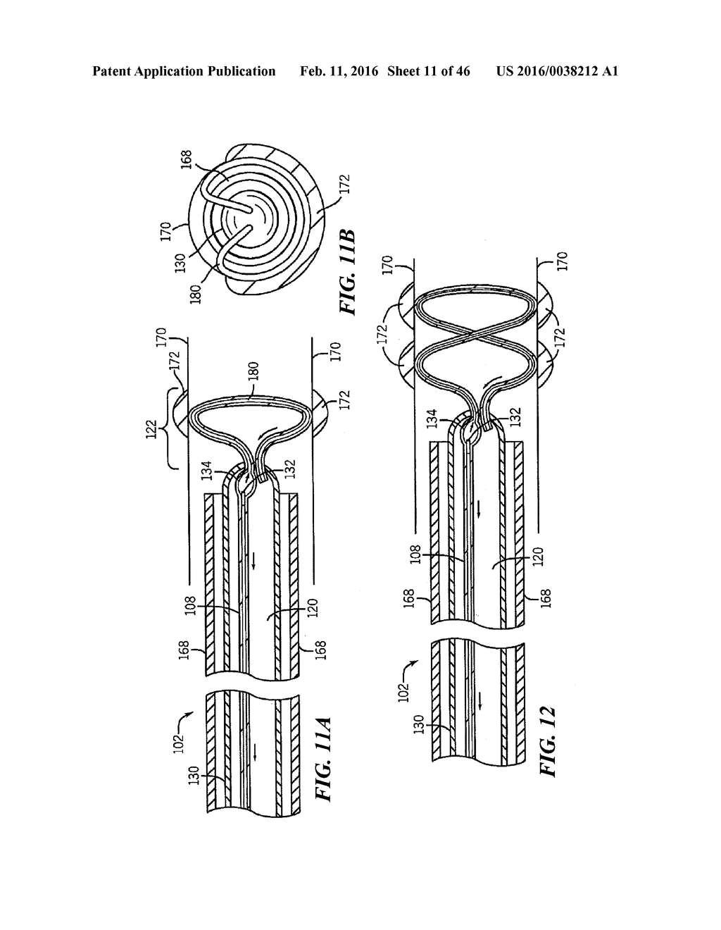 Cryoablation Apparatuses, Systems, and Methods for Renal Neuromodulation - diagram, schematic, and image 12