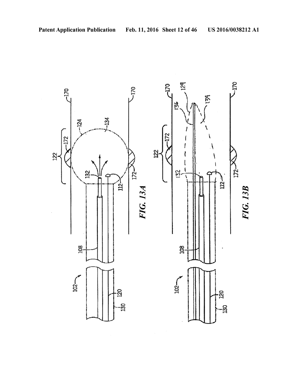 Cryoablation Apparatuses, Systems, and Methods for Renal Neuromodulation - diagram, schematic, and image 13