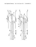 Cryoablation Apparatuses, Systems, and Methods for Renal Neuromodulation diagram and image