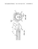 Cryoablation Apparatuses, Systems, and Methods for Renal Neuromodulation diagram and image