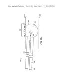 Cryoablation Apparatuses, Systems, and Methods for Renal Neuromodulation diagram and image