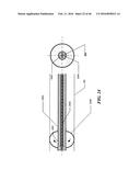 Cryoablation Apparatuses, Systems, and Methods for Renal Neuromodulation diagram and image