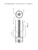 Cryoablation Apparatuses, Systems, and Methods for Renal Neuromodulation diagram and image