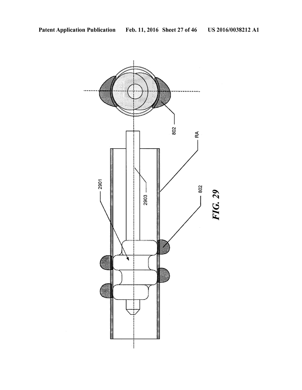 Cryoablation Apparatuses, Systems, and Methods for Renal Neuromodulation - diagram, schematic, and image 28