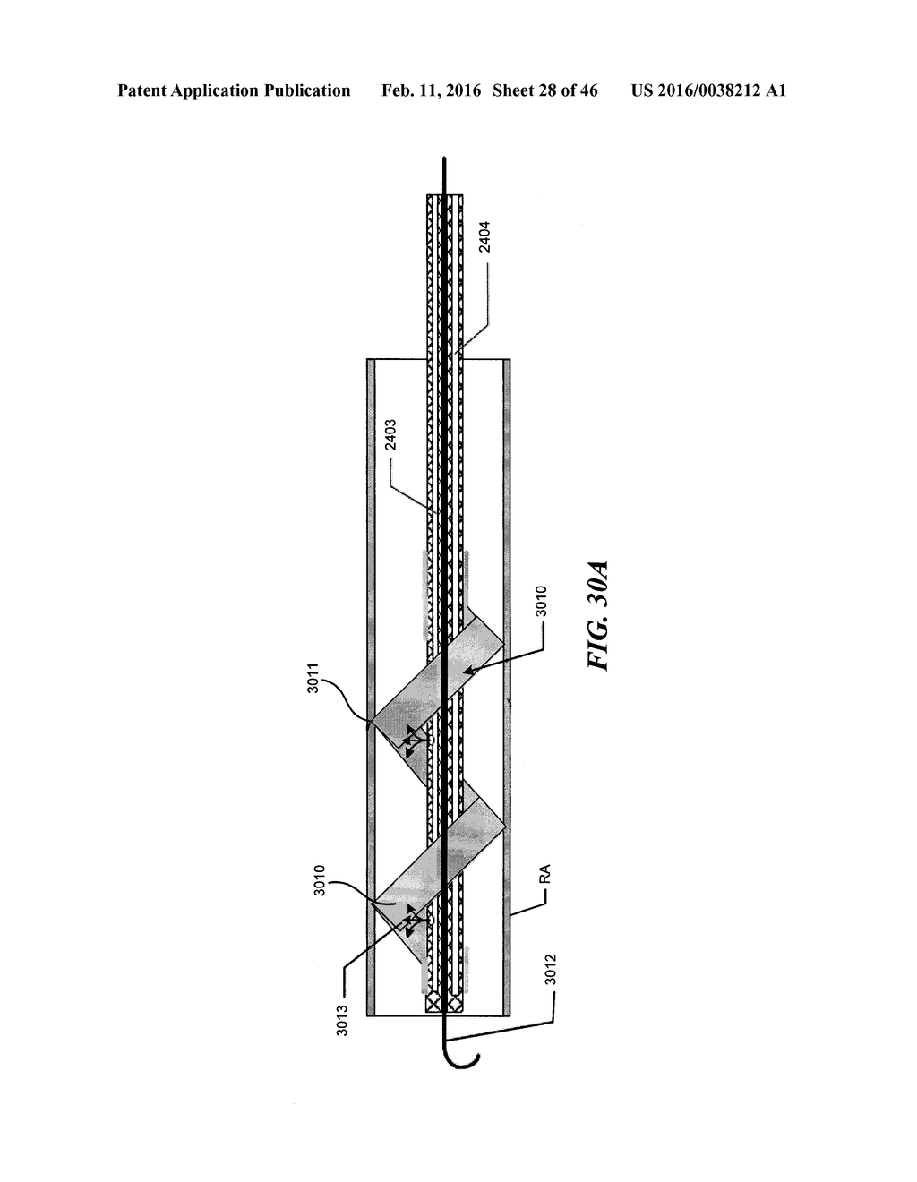 Cryoablation Apparatuses, Systems, and Methods for Renal Neuromodulation - diagram, schematic, and image 29