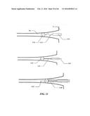 Cryoablation Apparatuses, Systems, and Methods for Renal Neuromodulation diagram and image