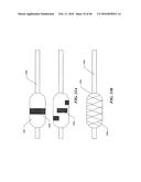 Cryoablation Apparatuses, Systems, and Methods for Renal Neuromodulation diagram and image