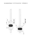 Cryoablation Apparatuses, Systems, and Methods for Renal Neuromodulation diagram and image