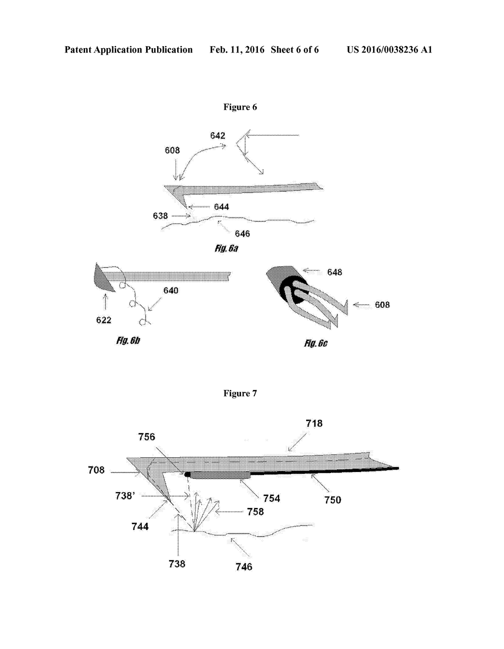 DEVICE FOR TISSUE REMOVAL - diagram, schematic, and image 07