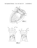 METHOD OF ANALYZING HOLLOW ANATOMICAL STRUCTURES FOR PERCUTANEOUS     IMPLANTATION diagram and image