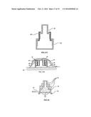 METHODS FOR DISPLACING THE SCHNEIDERIAN MEMBRANE diagram and image