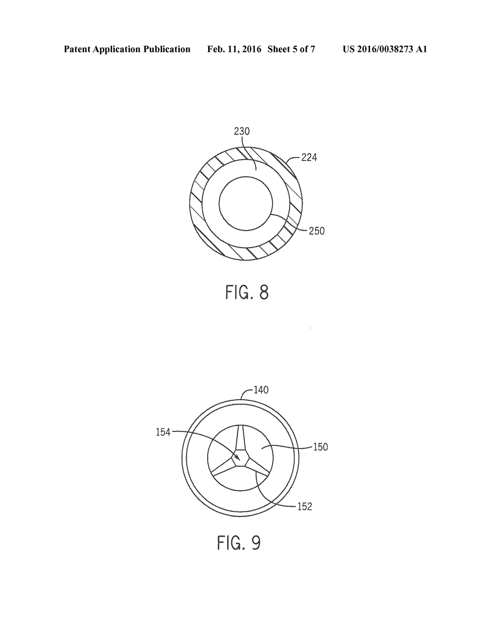 SYSTEM AND METHOD FOR USE OF FLEXIBLE ANTI-REFLUX URETERAL STENT - diagram, schematic, and image 06