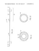 SYSTEM AND METHOD FOR USE OF FLEXIBLE ANTI-REFLUX URETERAL STENT diagram and image