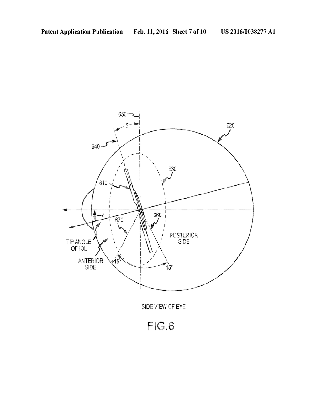 Optical Surface Systems and Methods for Treatment of Presbyopia and Other     Vision Conditions - diagram, schematic, and image 08