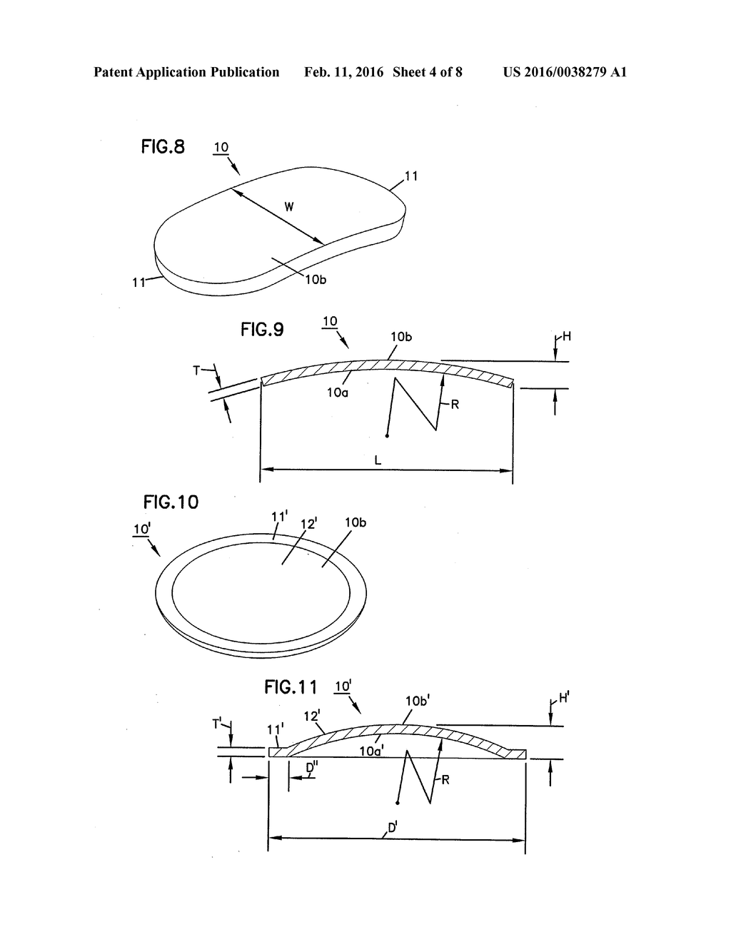 NASAL VALVE TREATMENT METHOD & APPARATUS - diagram, schematic, and image 05