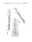 NASAL VALVE TREATMENT METHOD & APPARATUS diagram and image