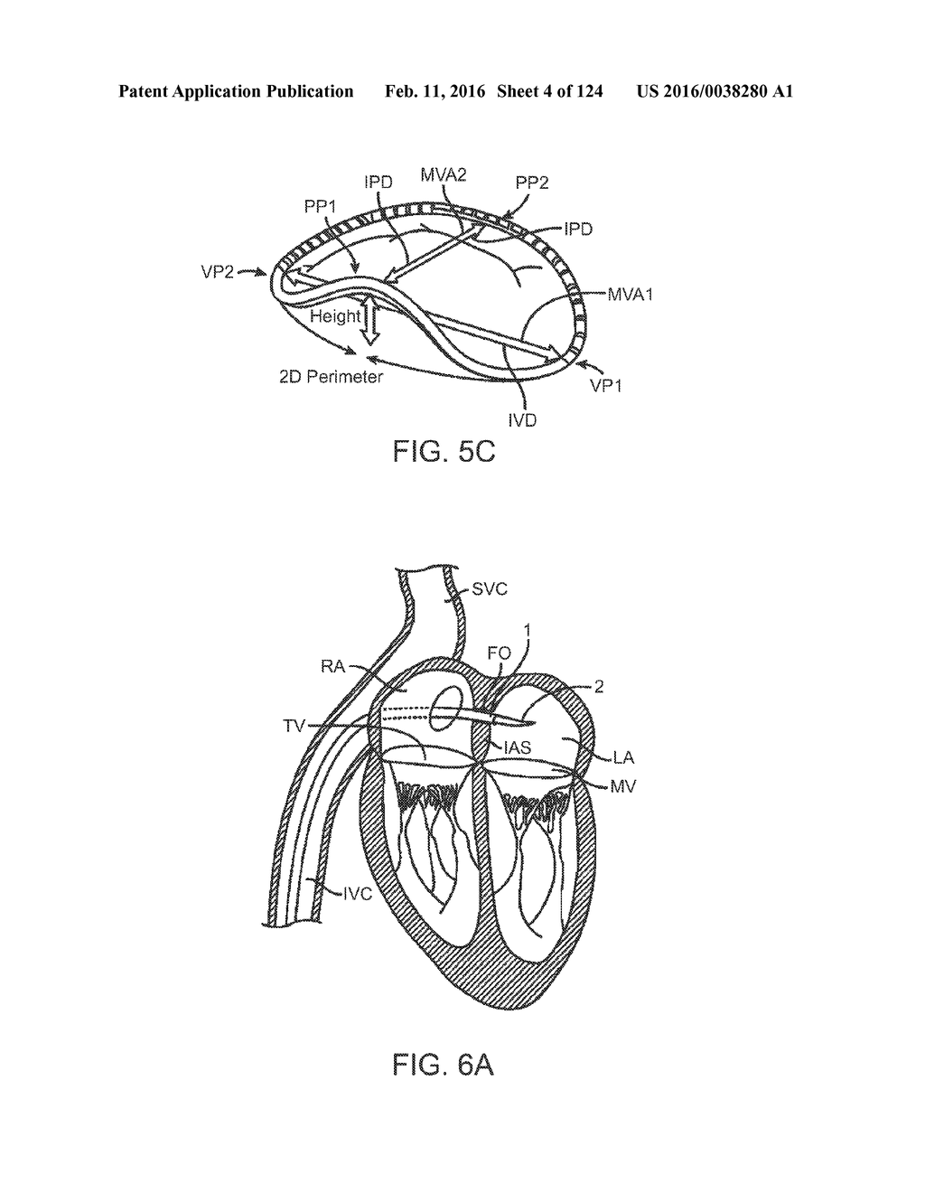 PROSTHETIC HEART VALVE DEVICES, PROSTHETIC MITRAL VALVES AND ASSOCIATED     SYSTEMS AND METHODS - diagram, schematic, and image 05