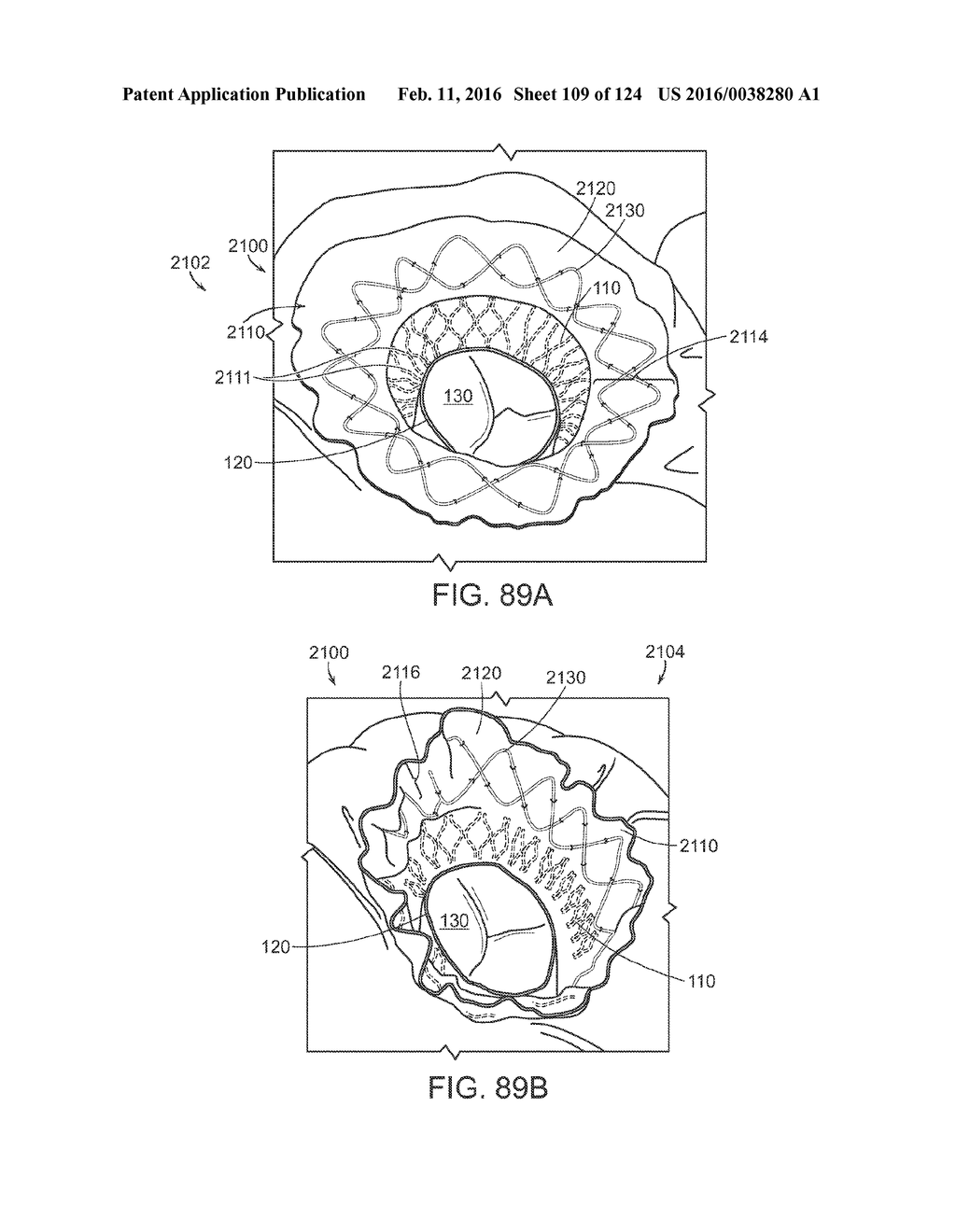 PROSTHETIC HEART VALVE DEVICES, PROSTHETIC MITRAL VALVES AND ASSOCIATED     SYSTEMS AND METHODS - diagram, schematic, and image 110