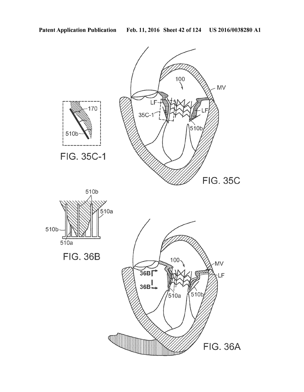 PROSTHETIC HEART VALVE DEVICES, PROSTHETIC MITRAL VALVES AND ASSOCIATED     SYSTEMS AND METHODS - diagram, schematic, and image 43