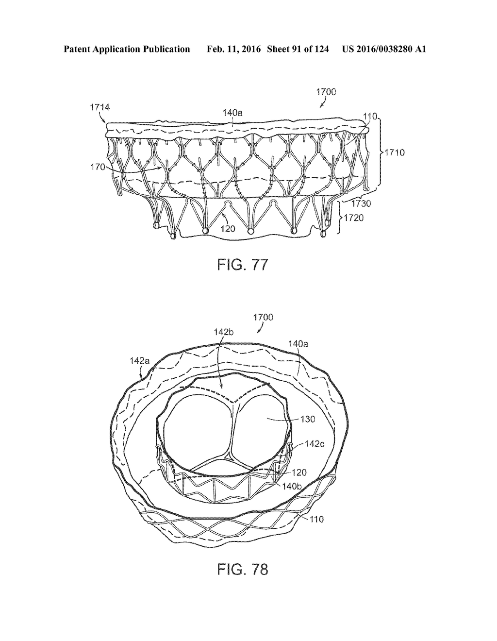 PROSTHETIC HEART VALVE DEVICES, PROSTHETIC MITRAL VALVES AND ASSOCIATED     SYSTEMS AND METHODS - diagram, schematic, and image 92