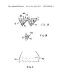 IMPROVEMENTS RELATING TO TRANSCATHETER STENT-VALVES diagram and image