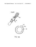 IMPROVEMENTS RELATING TO TRANSCATHETER STENT-VALVES diagram and image