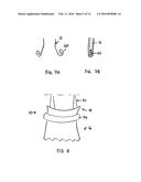 IMPROVEMENTS RELATING TO TRANSCATHETER STENT-VALVES diagram and image