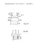 IMPROVEMENTS RELATING TO TRANSCATHETER STENT-VALVES diagram and image