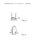 IMPROVEMENTS RELATING TO TRANSCATHETER STENT-VALVES diagram and image