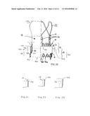 IMPROVEMENTS RELATING TO TRANSCATHETER STENT-VALVES diagram and image