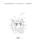 HEART VALVE PROSTHESIS WITH COLLAPSIBLE VALVE AND METHOD OF DELIVERY     THEREOF diagram and image