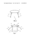 HEART VALVE PROSTHESIS WITH COLLAPSIBLE VALVE AND METHOD OF DELIVERY     THEREOF diagram and image